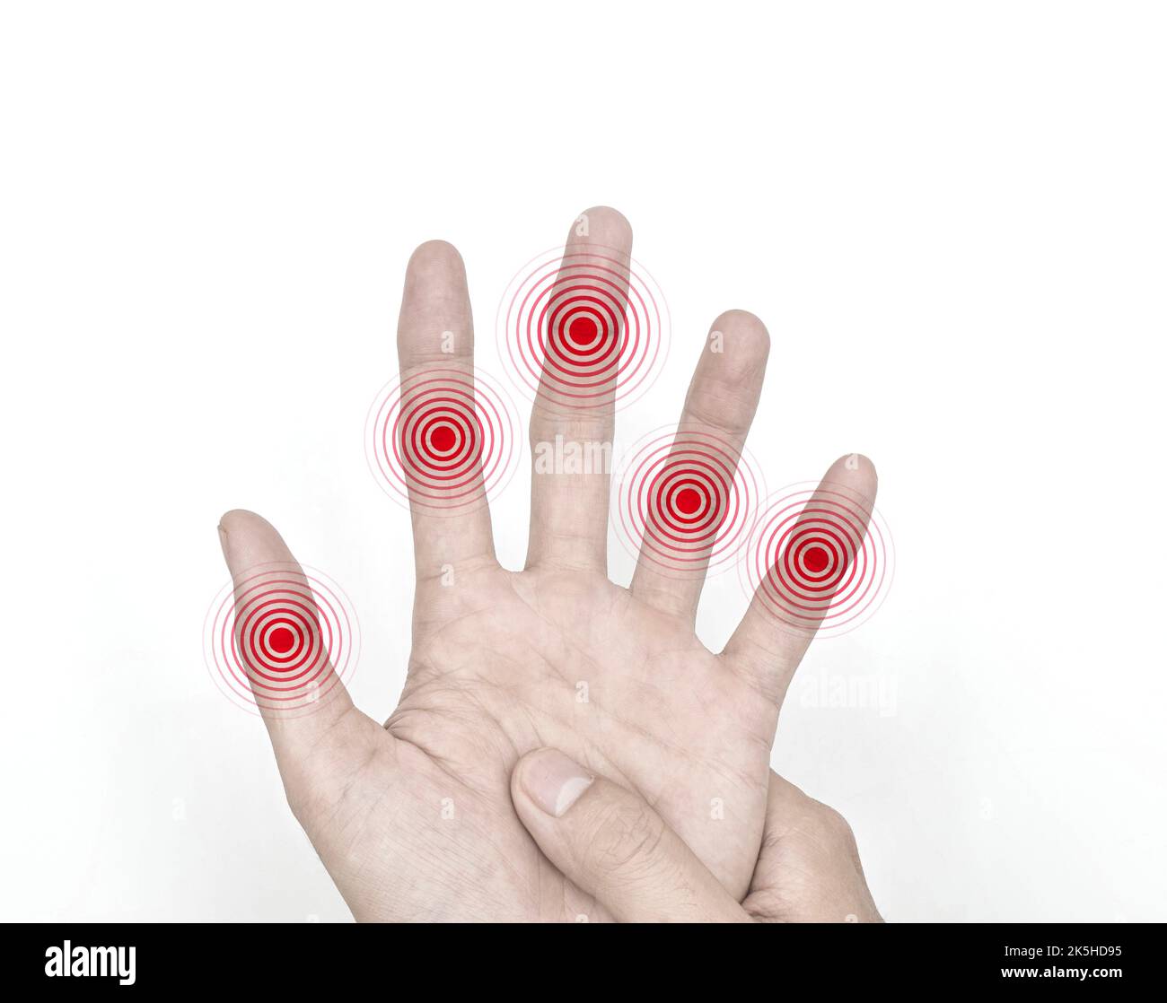 Multiple joints inflammation. Concept and idea of rheumatic arthritis, polyarthritis, hand joint swelling or arthralgia. Stock Photo