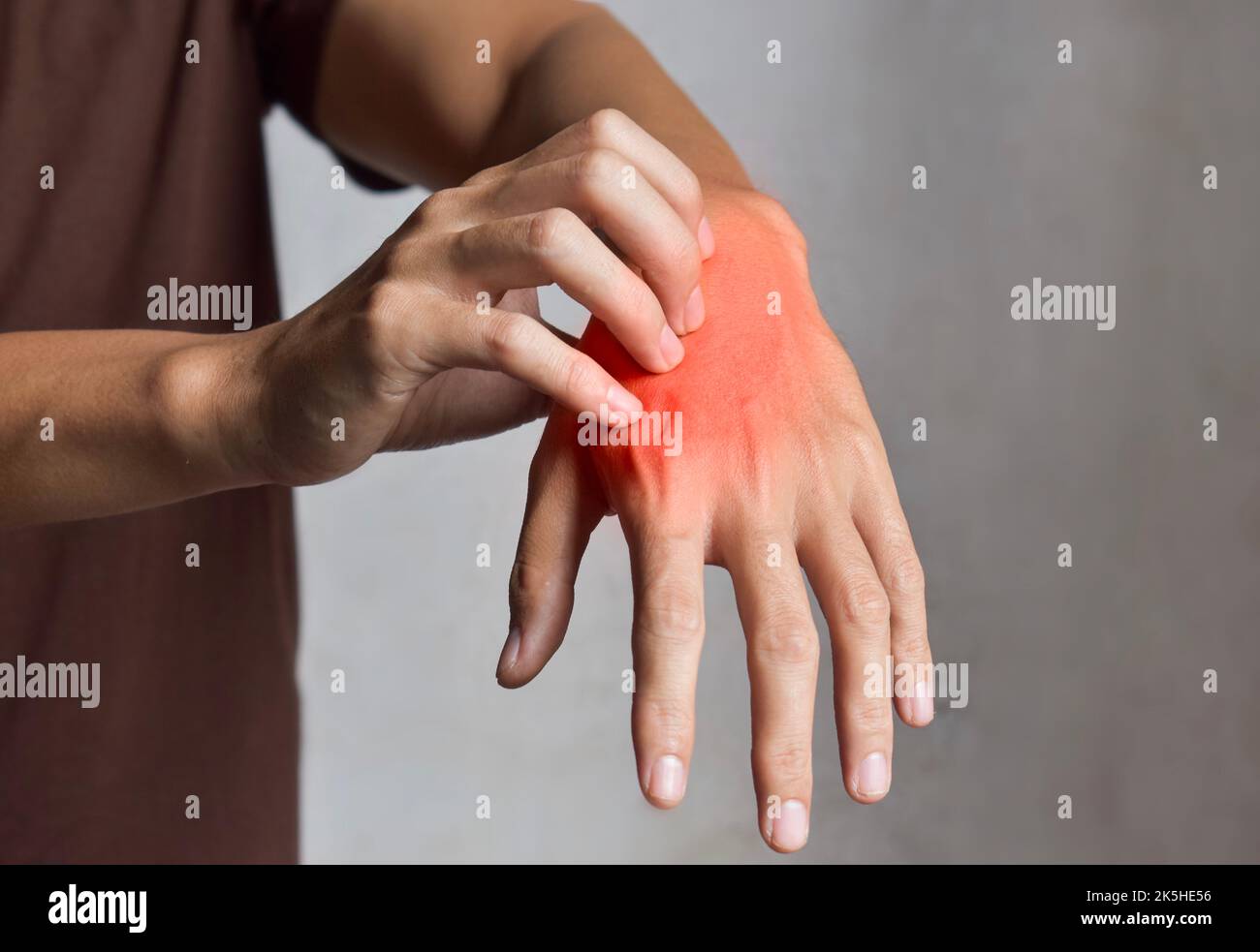 Asian young man scratching his hand. Concept of itchy skin diseases such as scabies, fungal infection, eczema, psoriasis, rash, allergy, etc. Stock Photo