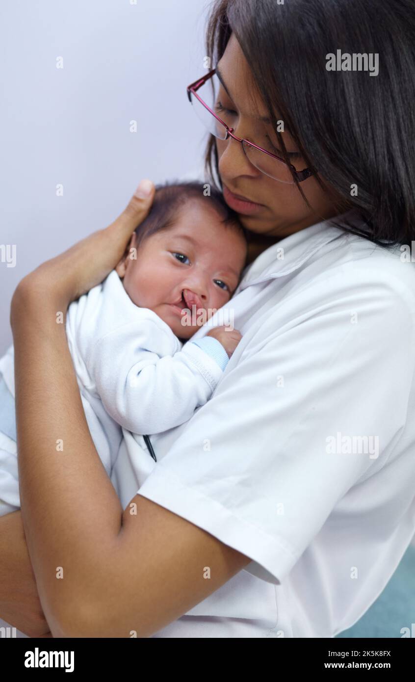 Giving comfort. A young infant with a cleft palate being comforted ber her mother. Stock Photo