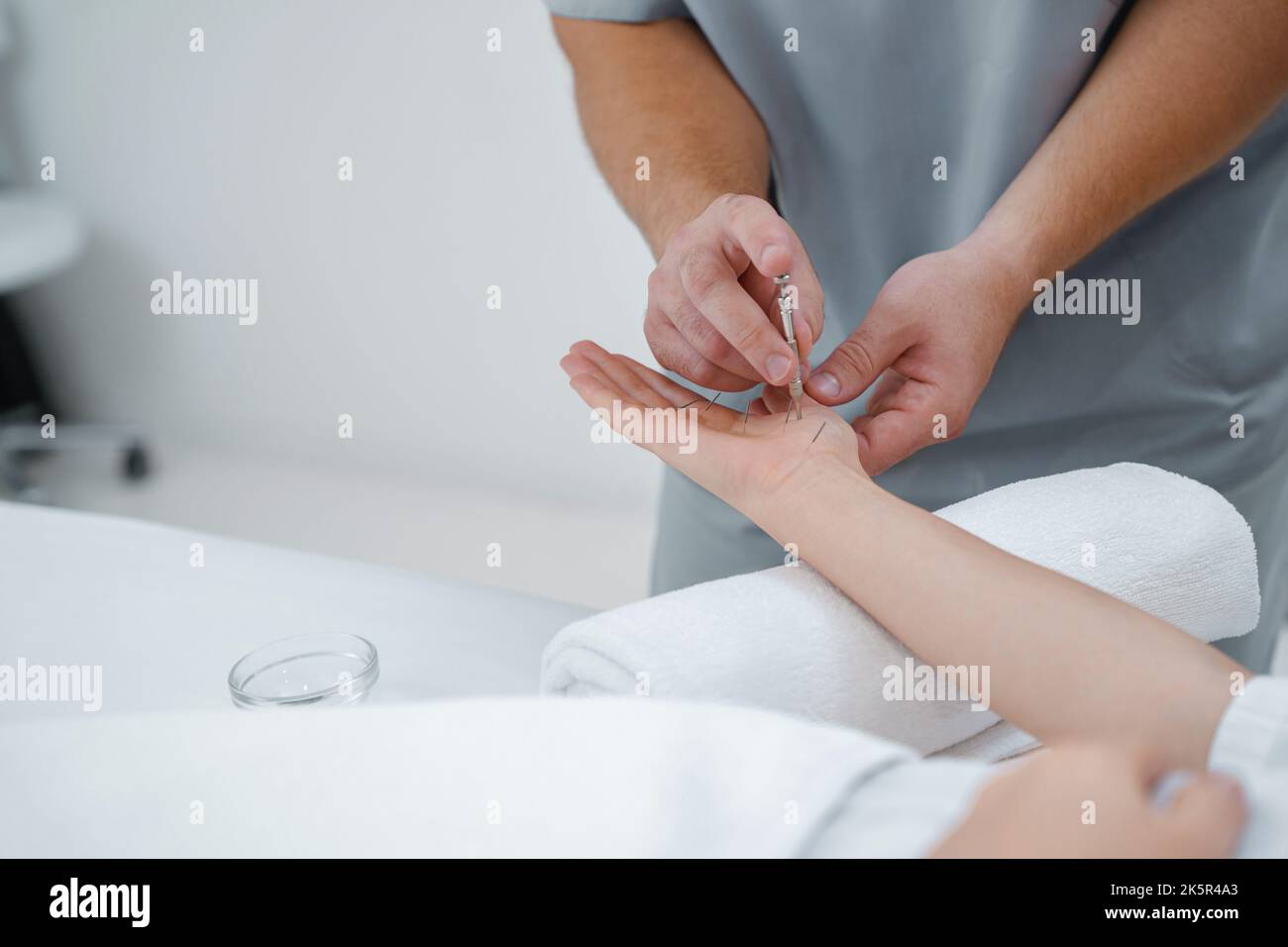 Acupuncture procedure hi-res stock photography and images - Alamy