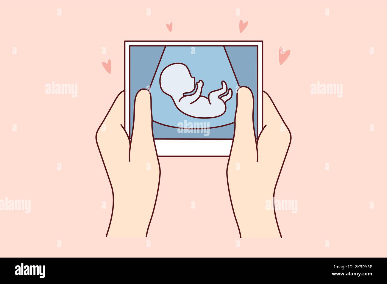 Hands of person holding scan of embryo waiting for baby birth. Future ...