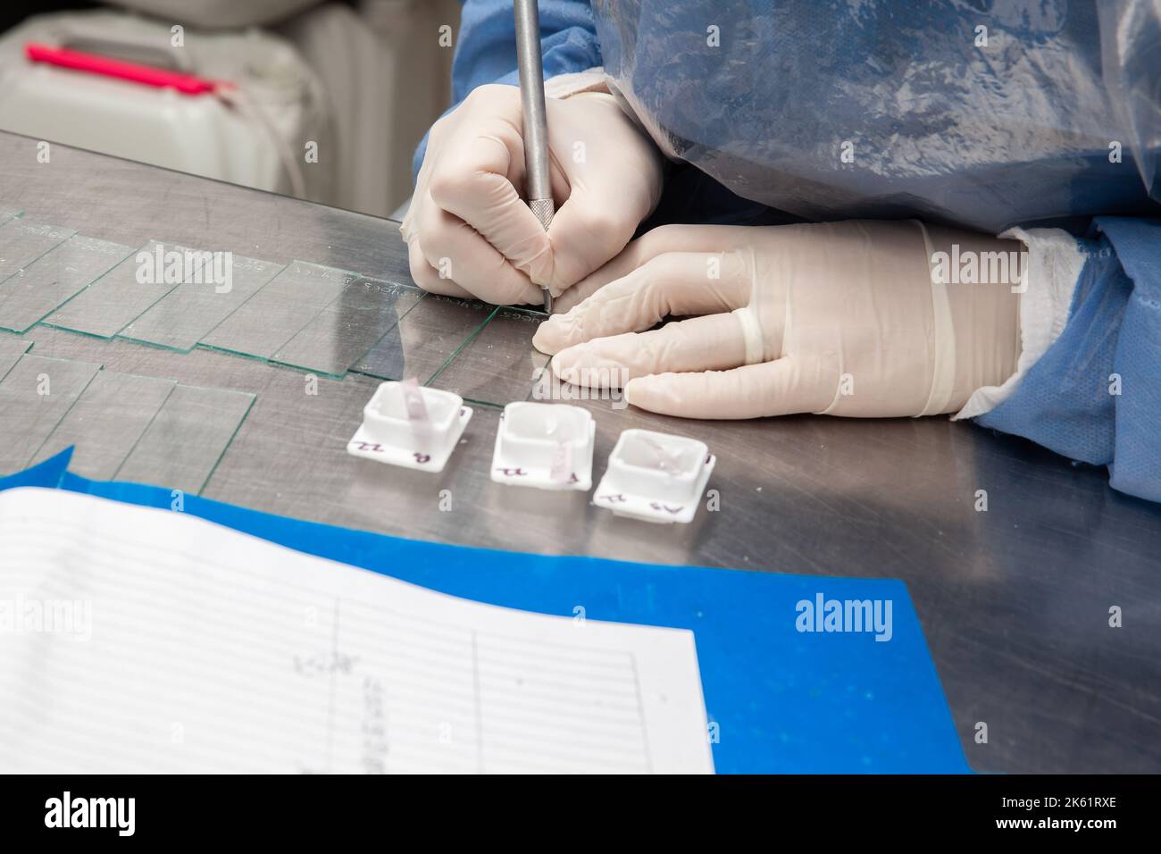 Scientist preparing paraffin blocks containing biopsy tissue for sectioning. Pathology laboratory. Cancer diagnosis. Stock Photo