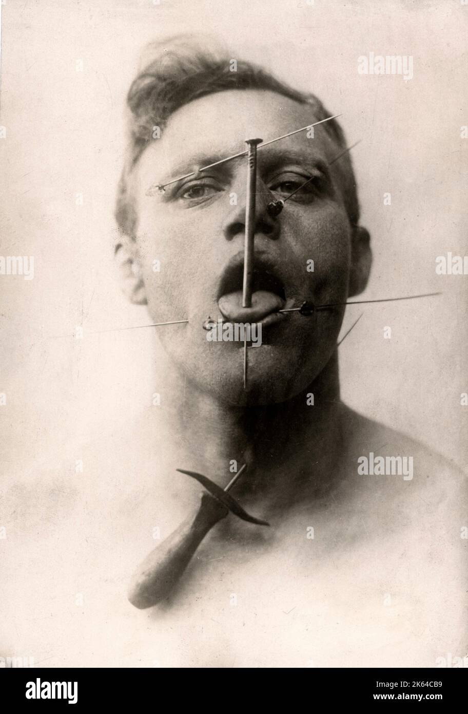 &amp;#39;A German Fakir&amp;#39; - man undergoing extreme acupuncture through his neck ...