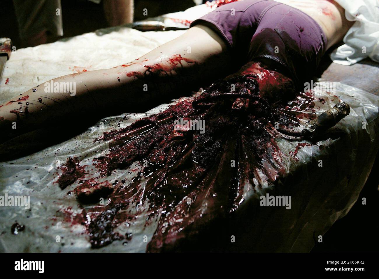 BODY WITH LEG CUT OFF, WRONG TURN, 2003 Stock Photo