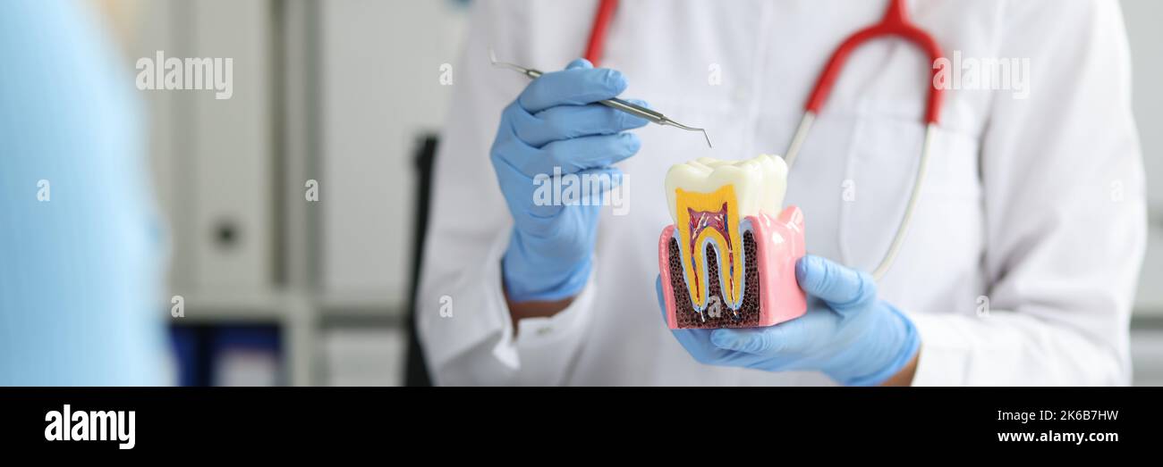 Dentist shows caries on artificial tooth and methods of treatment to ...