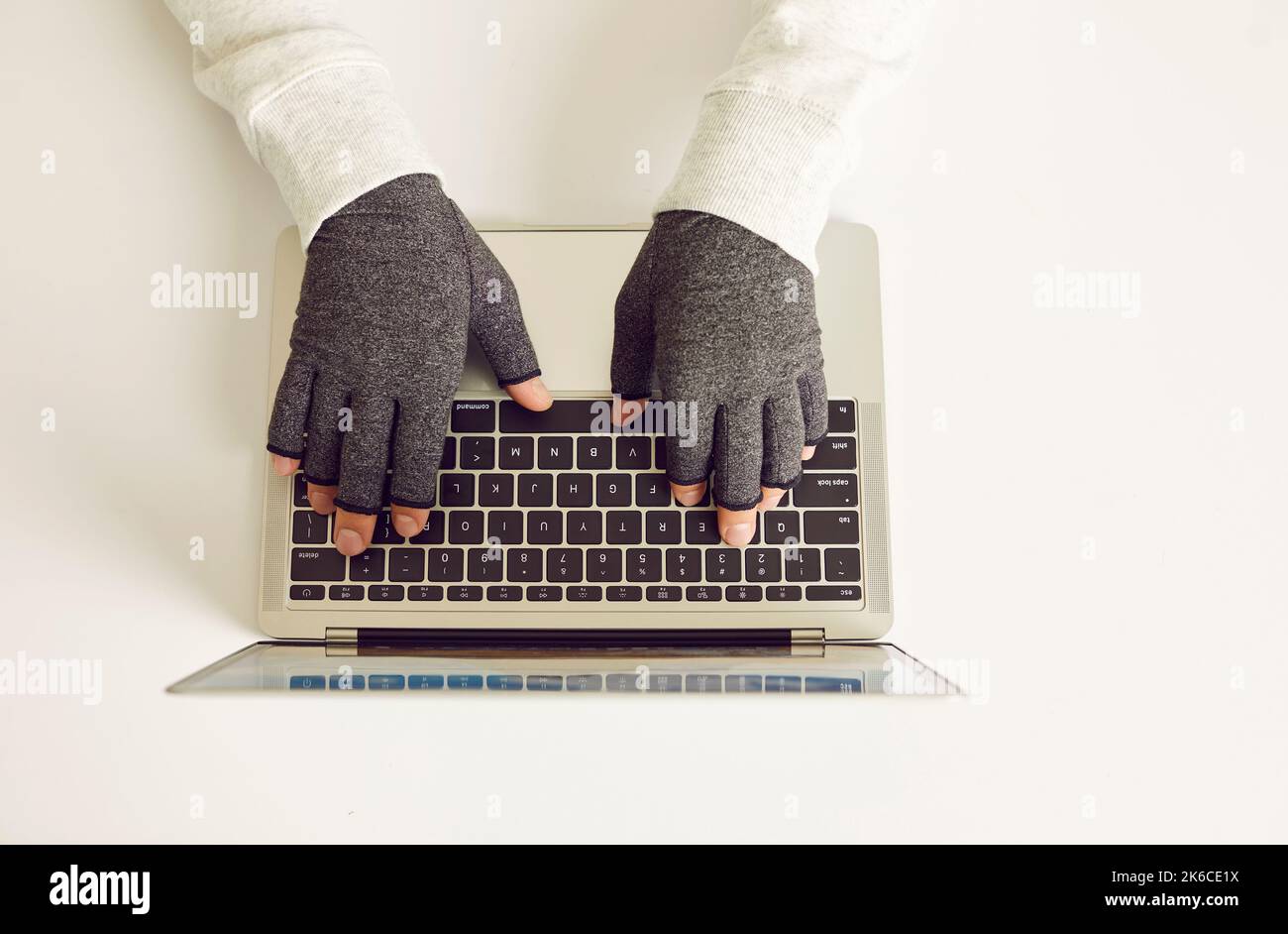 Man with rheumatoid arthritis working on laptop wearing compression gloves for easing pain Stock Photo