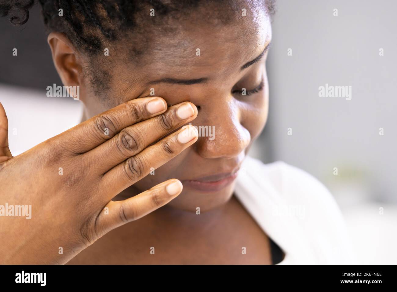 Eye Pain And Inflammation. Woman With Retina Fatigue And Spasm Stock Photo