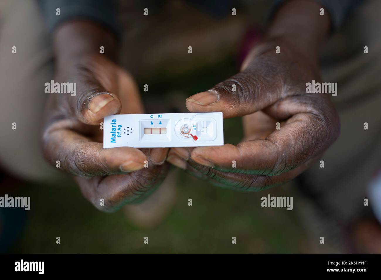A pair of hands hold a positive malaria rapid test in Uganda, East Africa. Stock Photo