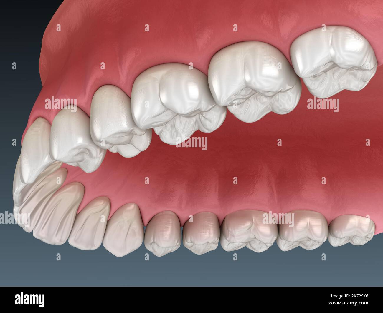 Maxillary human gum and teeth. Medically accurate tooth 3D illustration Stock Photo Alamy
