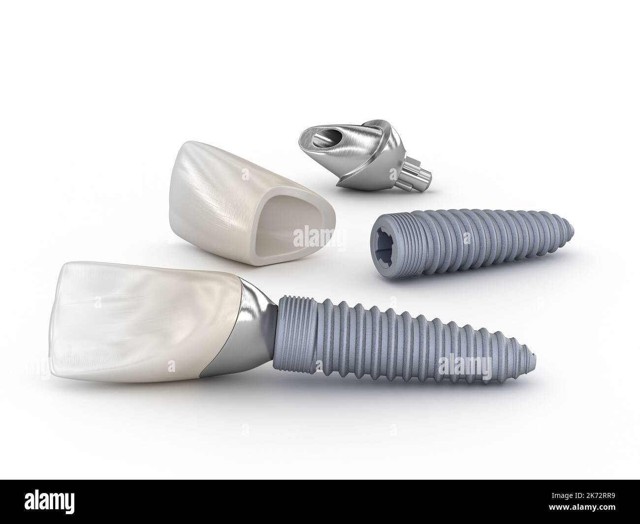 Ceramic crown, custom implant abutment and implantat. Medically