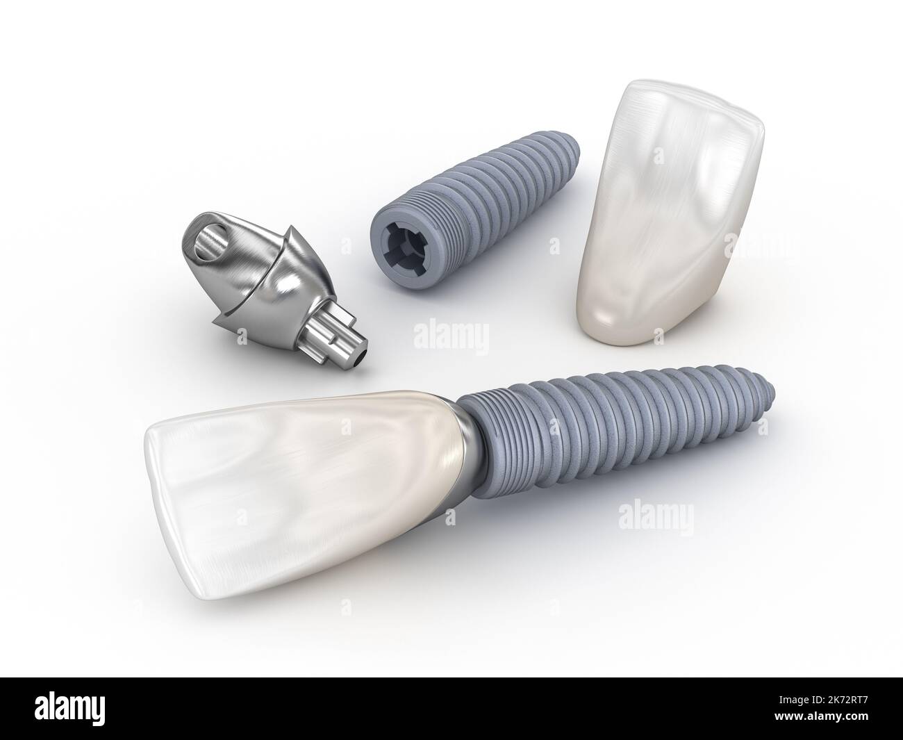 Ceramic crown, custom implant abutment and implantat. Medically