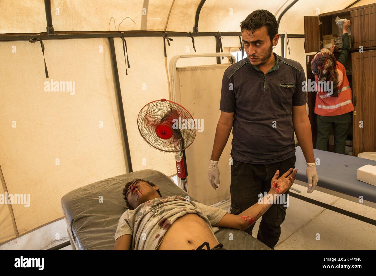 Juillet 2017 - Syrie - Rojava - Syrie du Nord - Camp de deplaces d'Ain Issa / Clinique MSF / Un syrien originaire de Raqqa a eu un accident de mobylette hors du camp. Les medecins interviennent aussi vite, le soignant de toute part Stock Photo