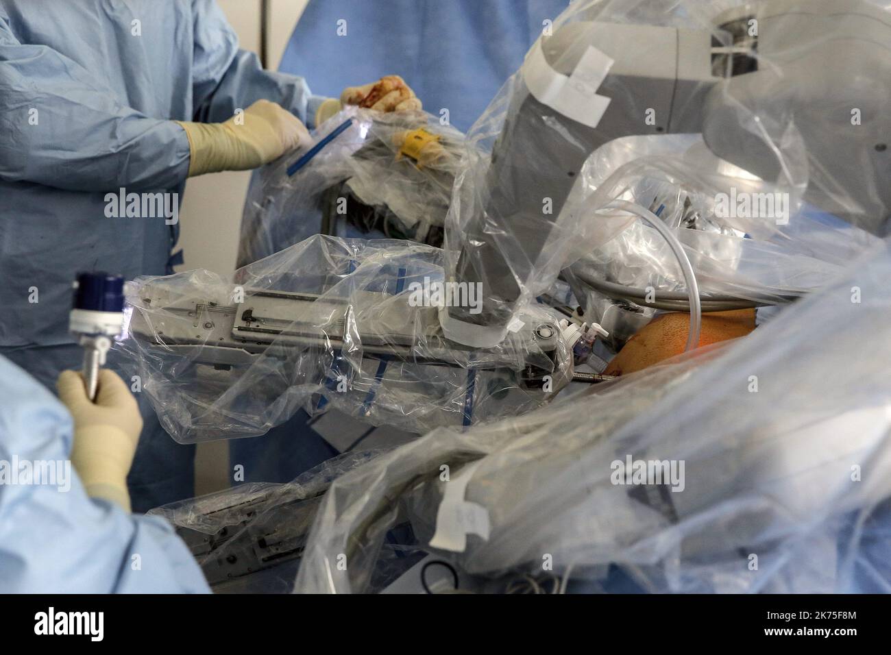 Robotic surgical operation at the Lyon Sud hospital The operating
