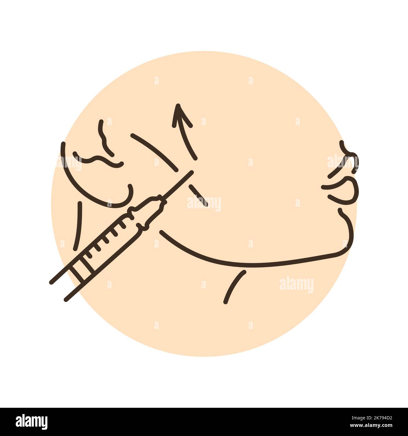 Fine cheekbone correction color line illustration. Hyaluronic injection ...