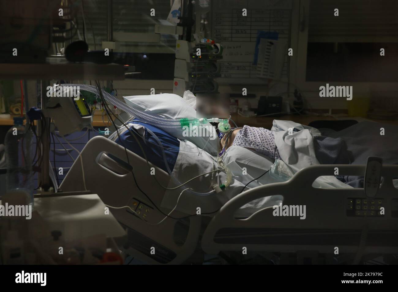 A nurse monitors the equipment. All patients with covid-19 are intubated and sometimes placed in the prone position to improve their ventilation. Stock Photo