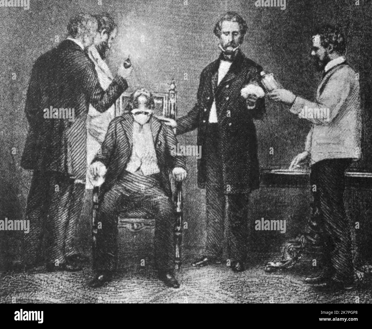 William Morton, William Thomas Green Morton administering ether anesthesia during the first successful public demonstration of its use during surgery Stock Photo