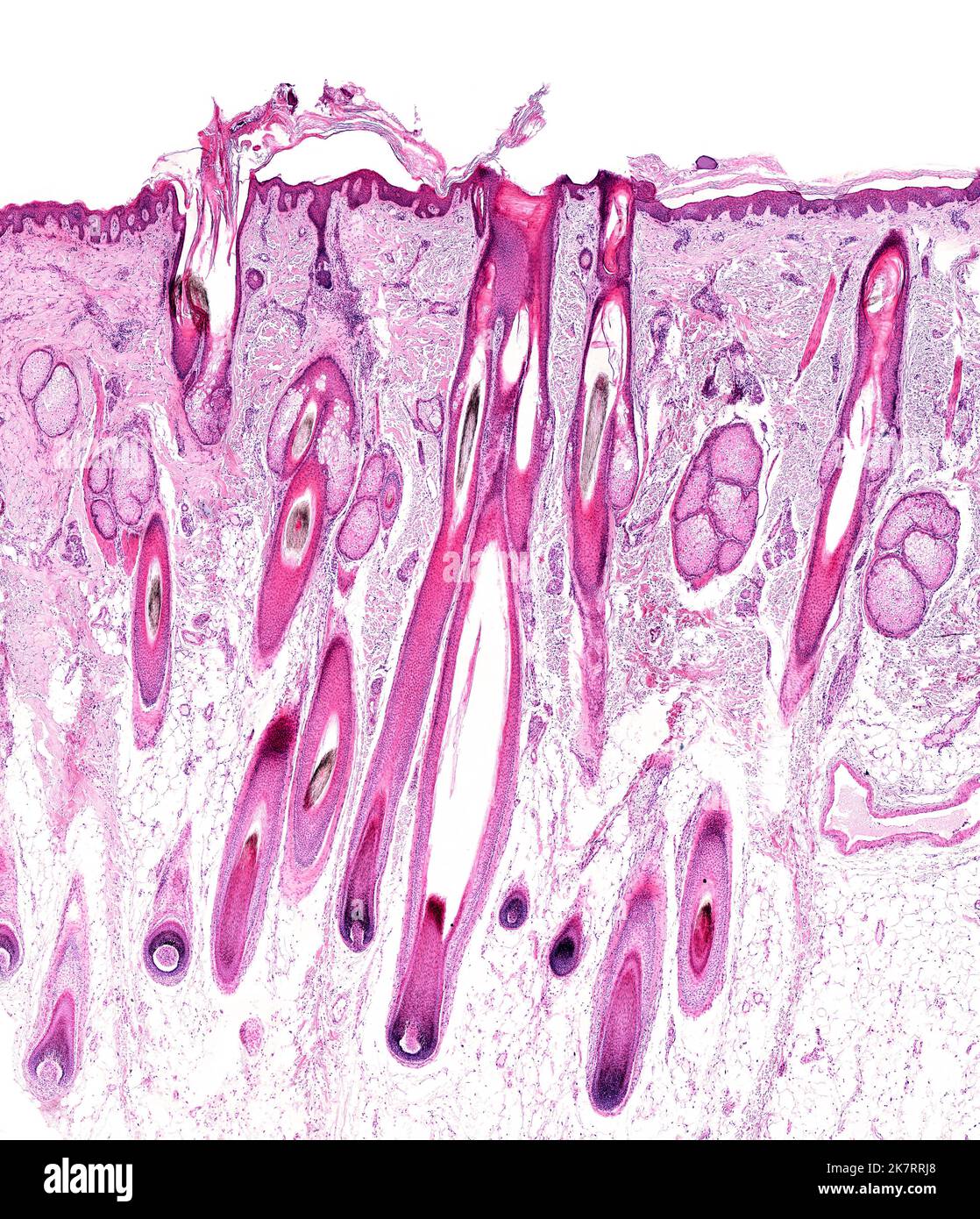 Light micrograph of human scalp skin showing hair follicles with their