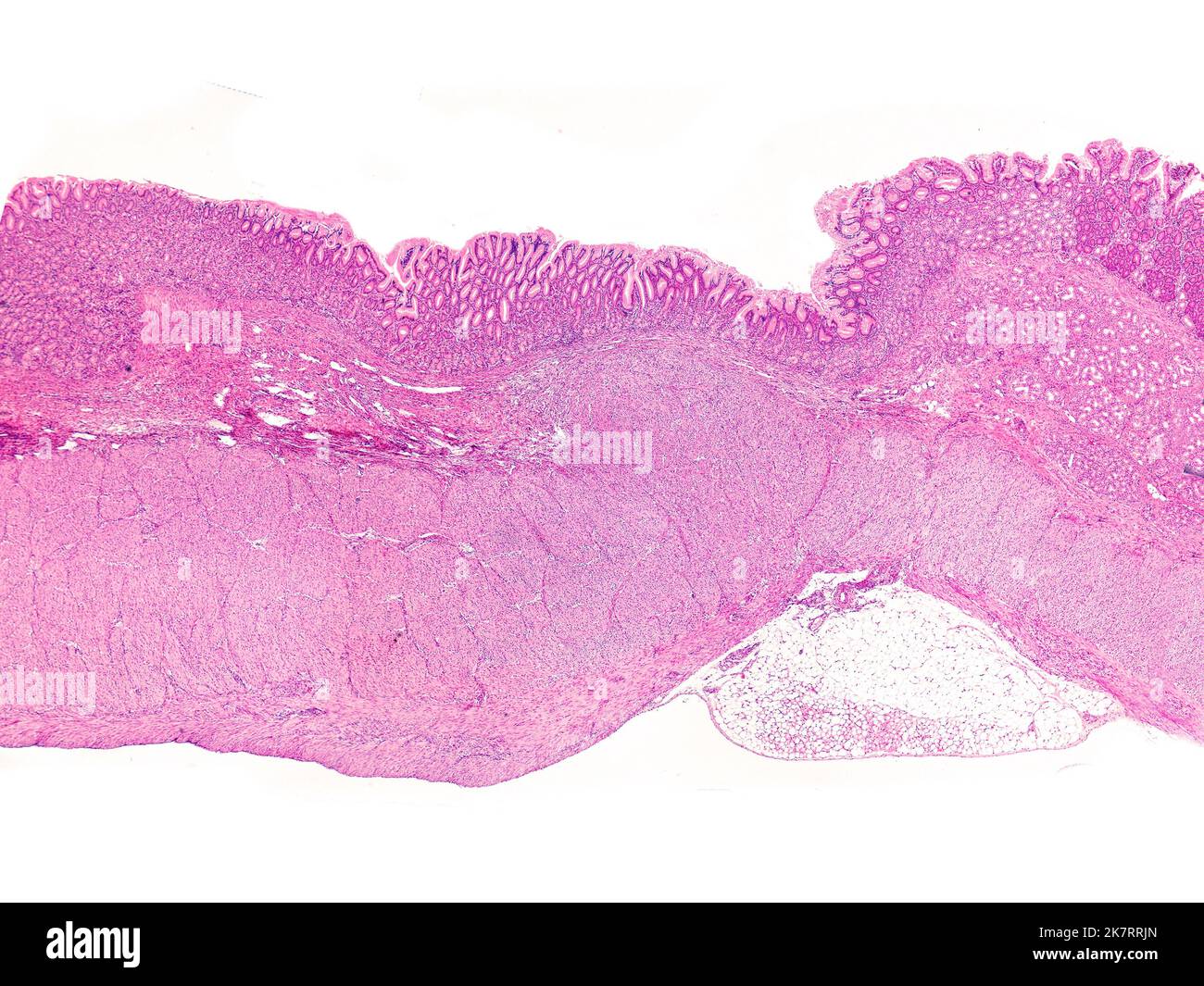 Light micrograph of a pylorus from a human stomach. At top is the