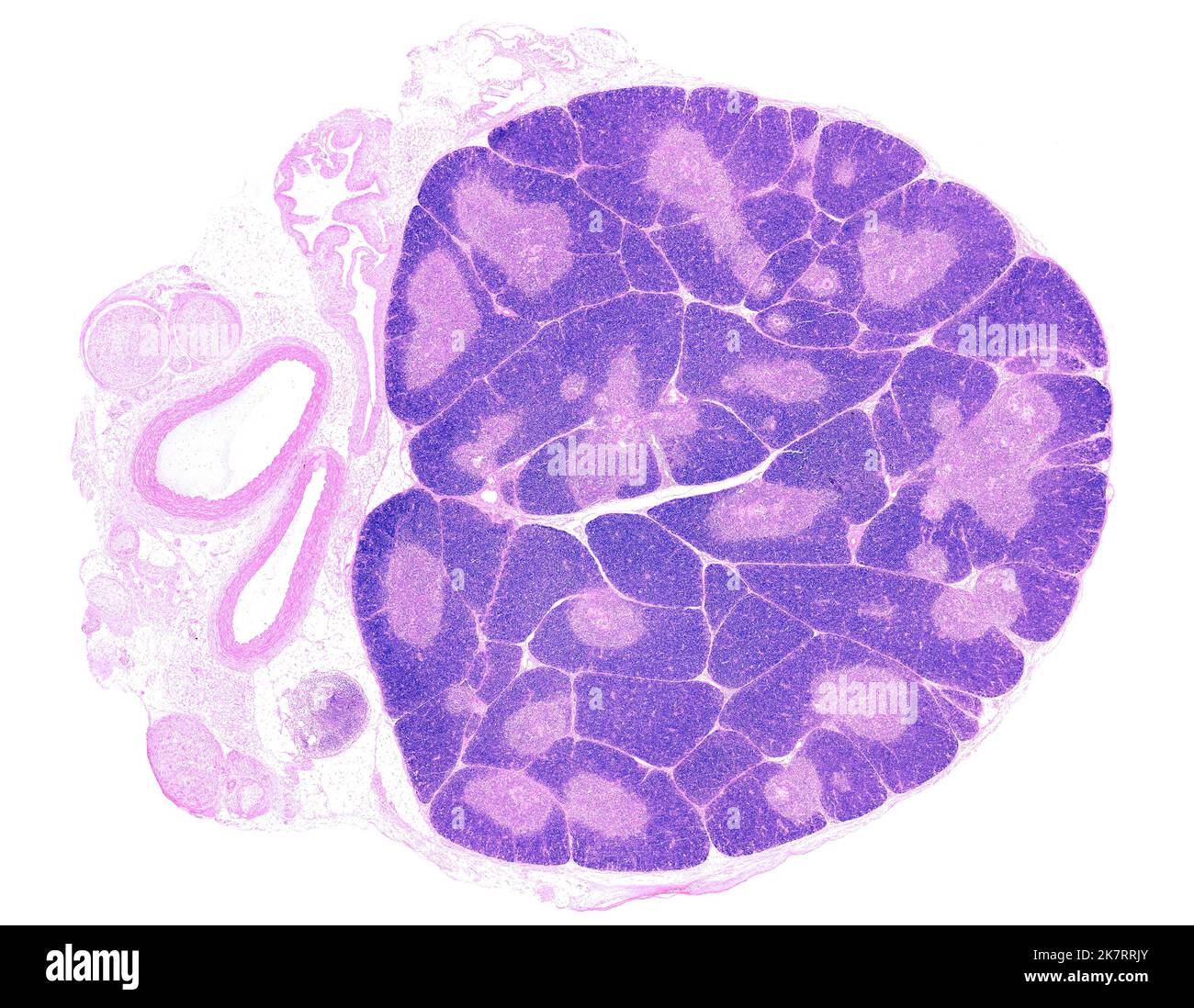 Light micrograph showing a young thymus. The organization into lobules ...