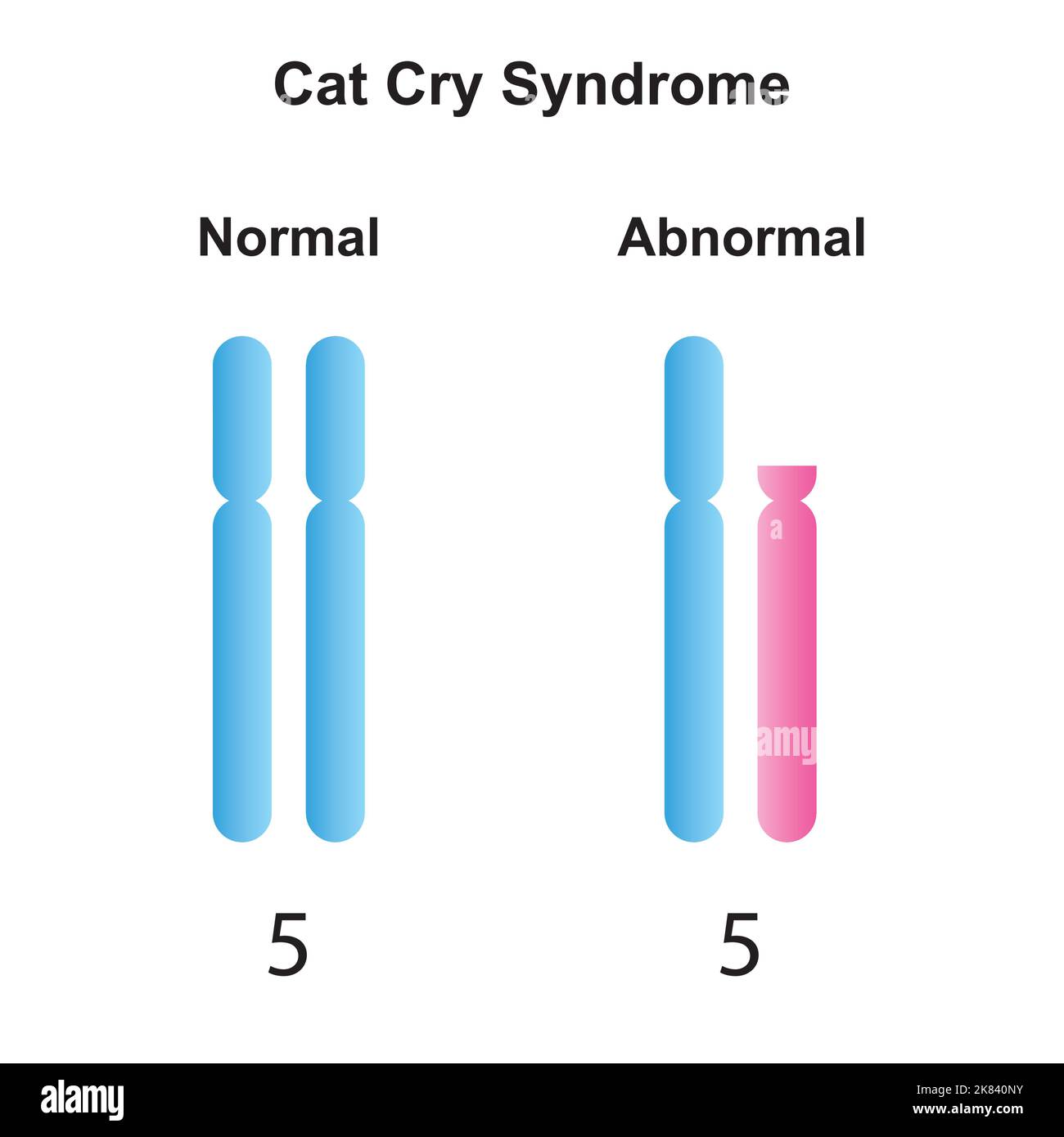 Scientific Designing of Cat Cry Syndrome. Colorful Symbols. Vector Illustration. Stock Vector