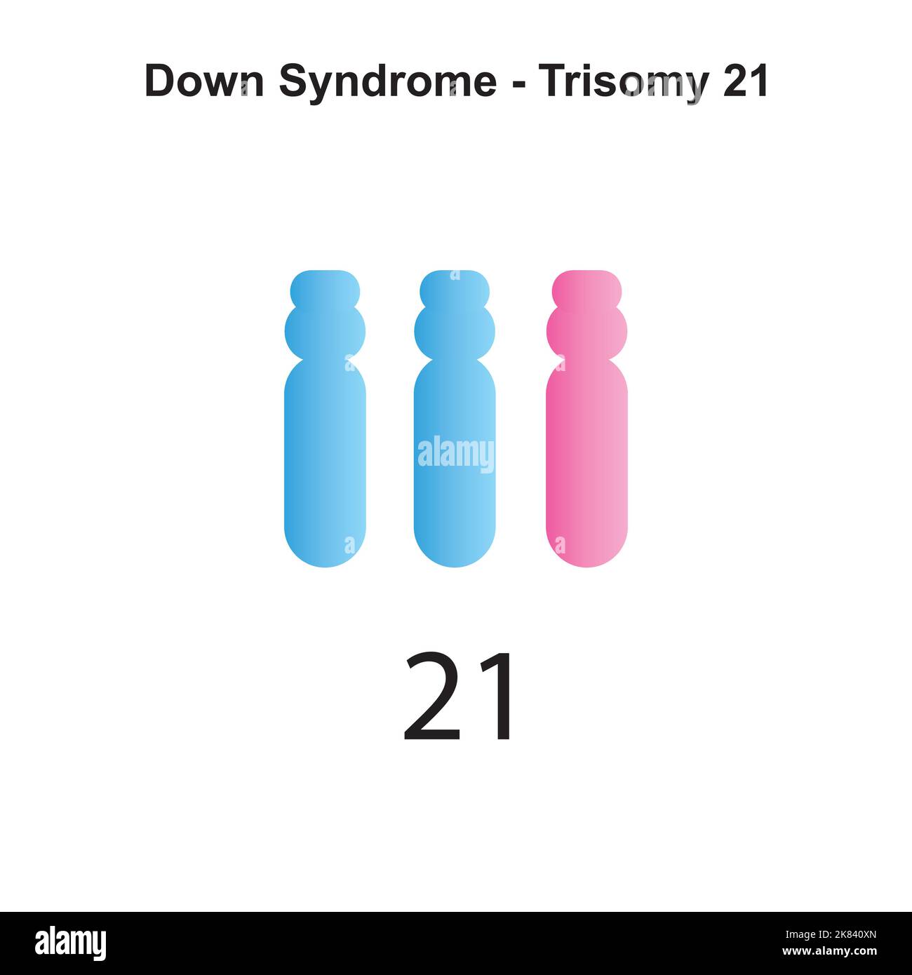 Trisomy 21 Cut Out Stock Images \u0026 Pictures - Alamy, image size:1300x1390