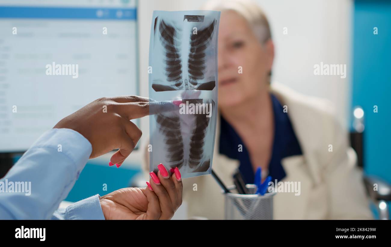 Health specialist explaining x ray scan results to elderly patient, finding bones diagnosis at