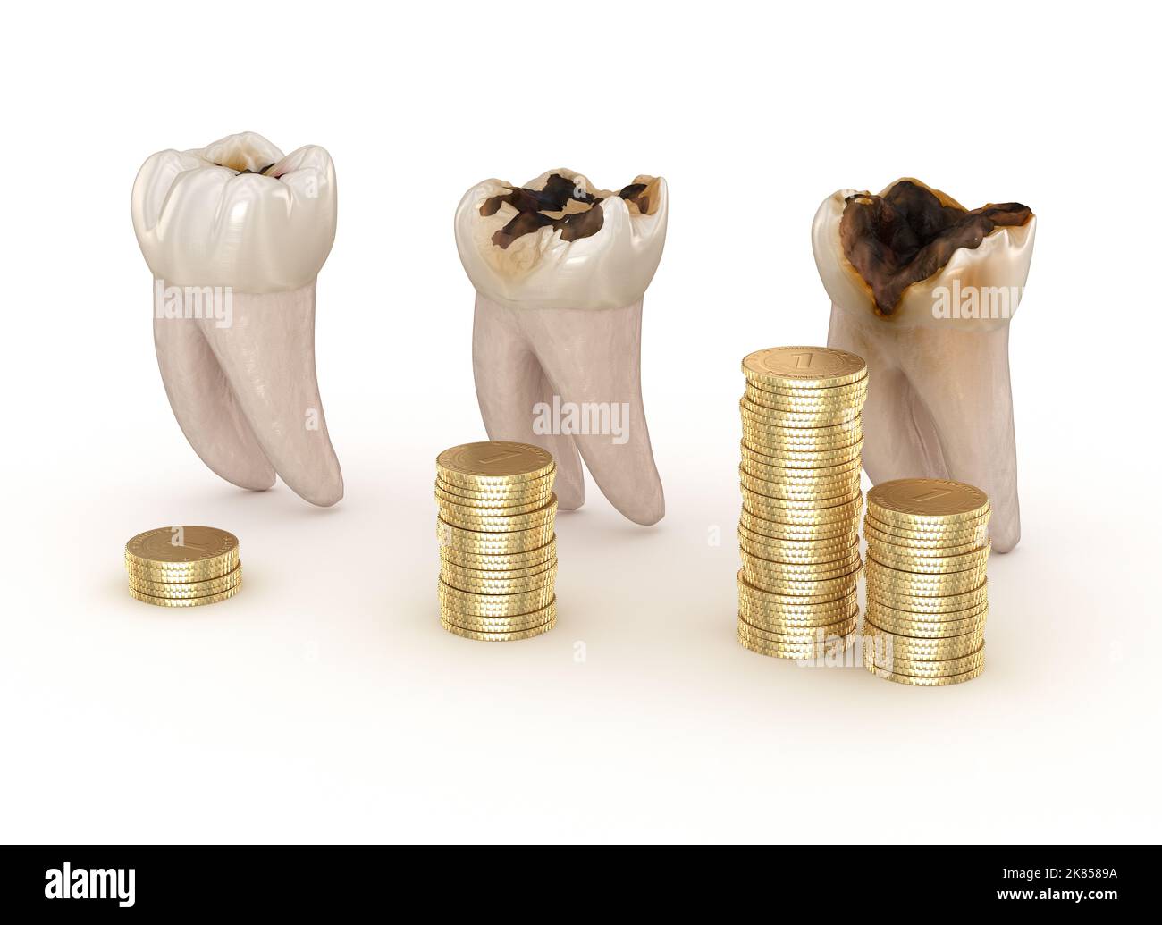 Dental restoration graph. 3D illustration concept Stock Photo Alamy