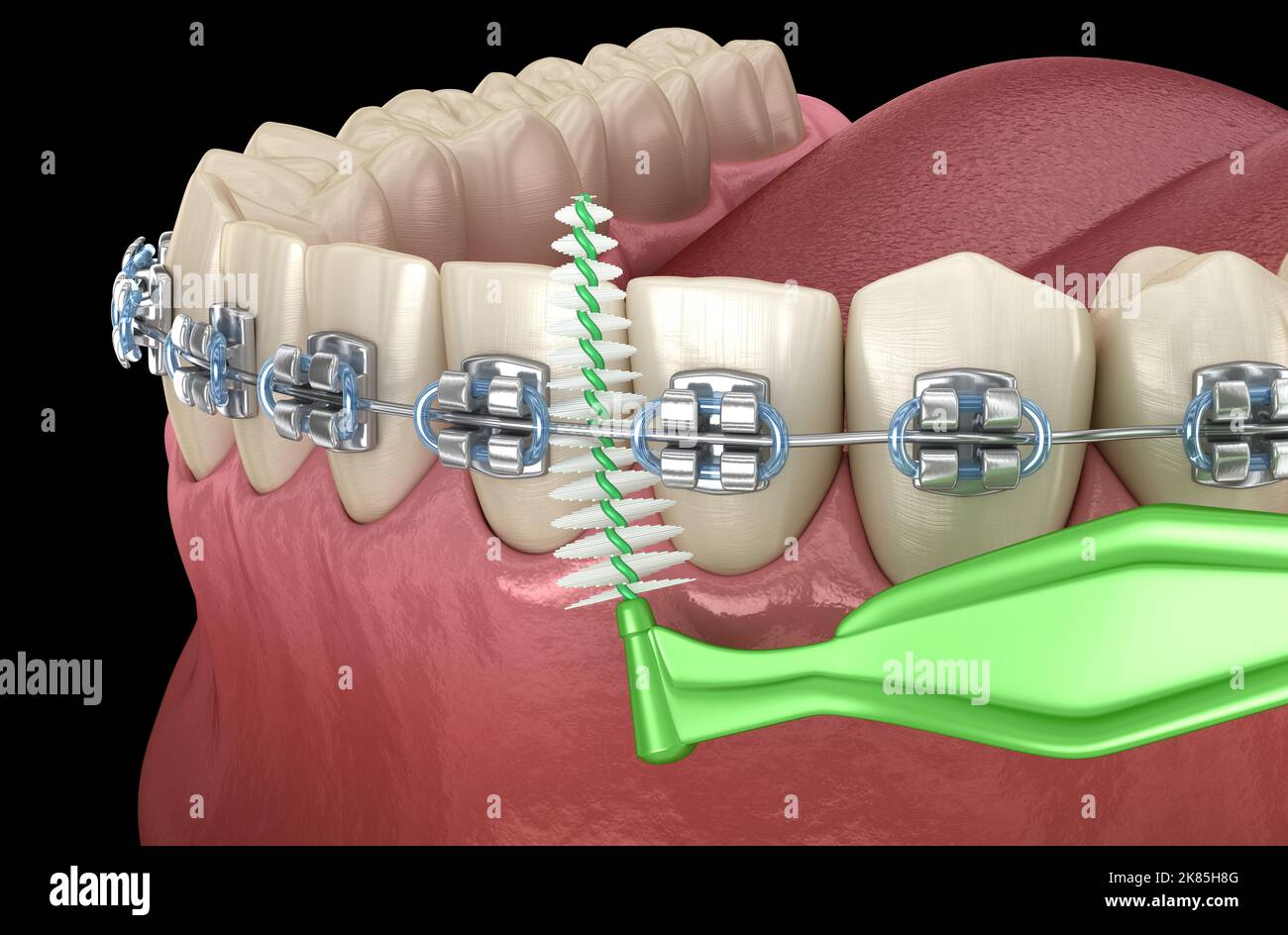 Interdental tooth brush and braces cleaning. Medically accurate 3D