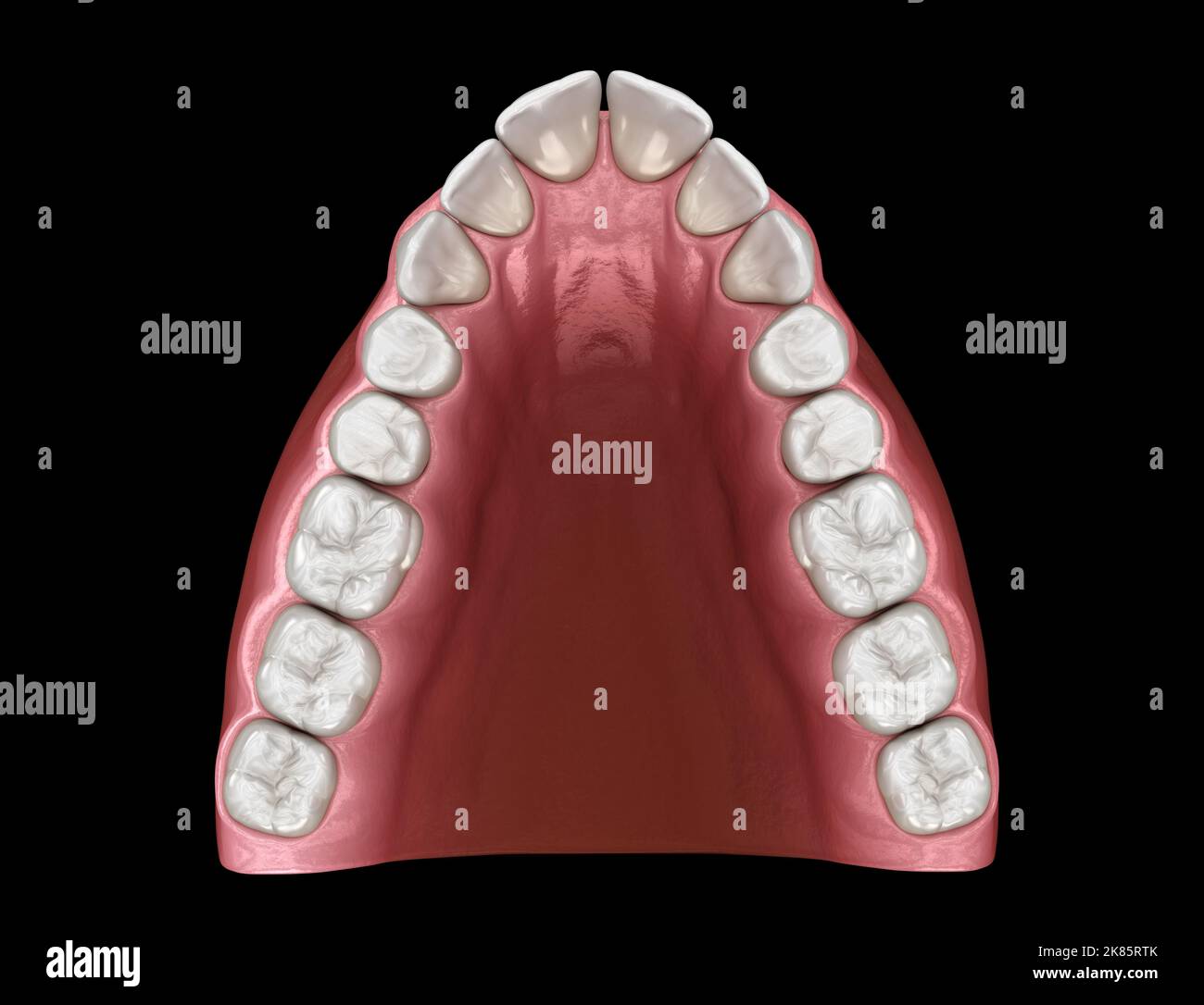 Vshape tapered arch form of maxilla. Medically accurate tooth 3D
