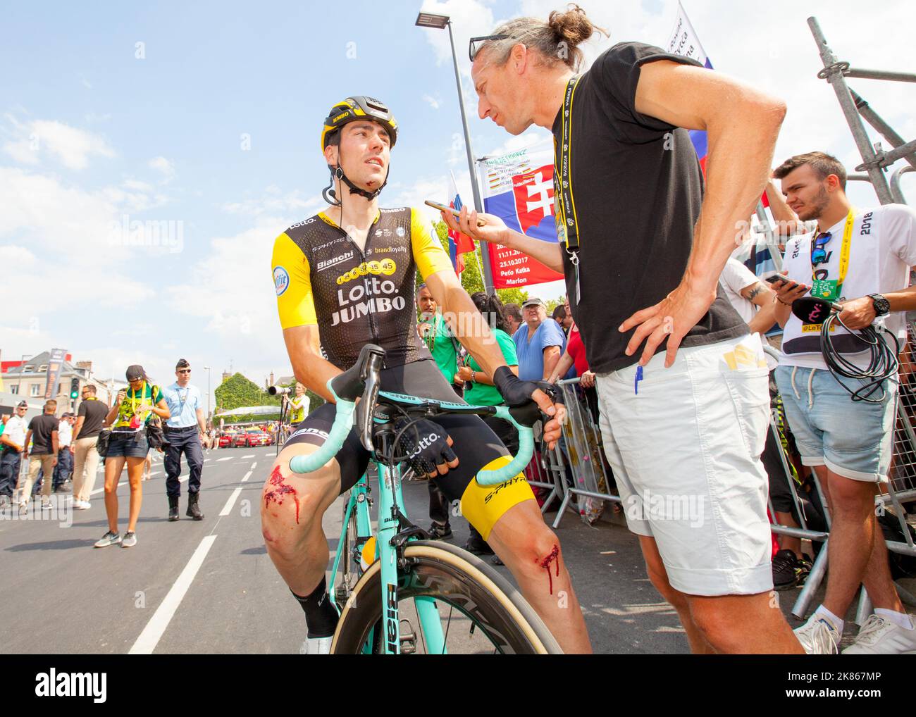 Timo ROOSEN (TEAM LOTTO NL â€“ JUMBO) looks unabashed at the blood coming off his knees Stock Photo