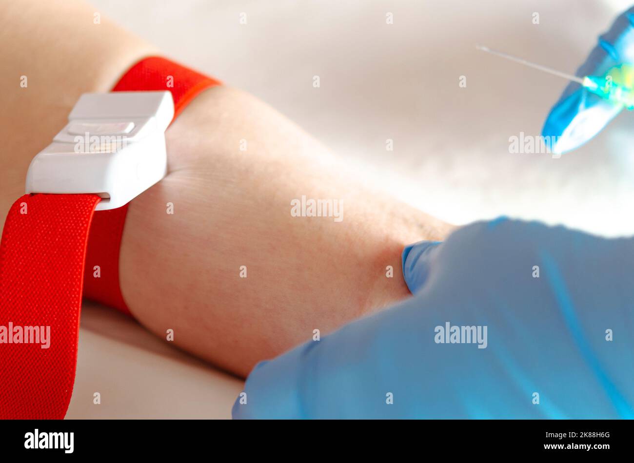 Woman's vein ready for intravenous injection during pandemic Stock