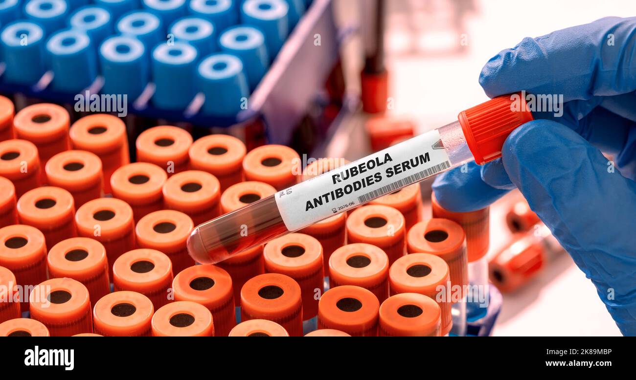 Rubeola antibody serum blood test, conceptual image Stock Photo