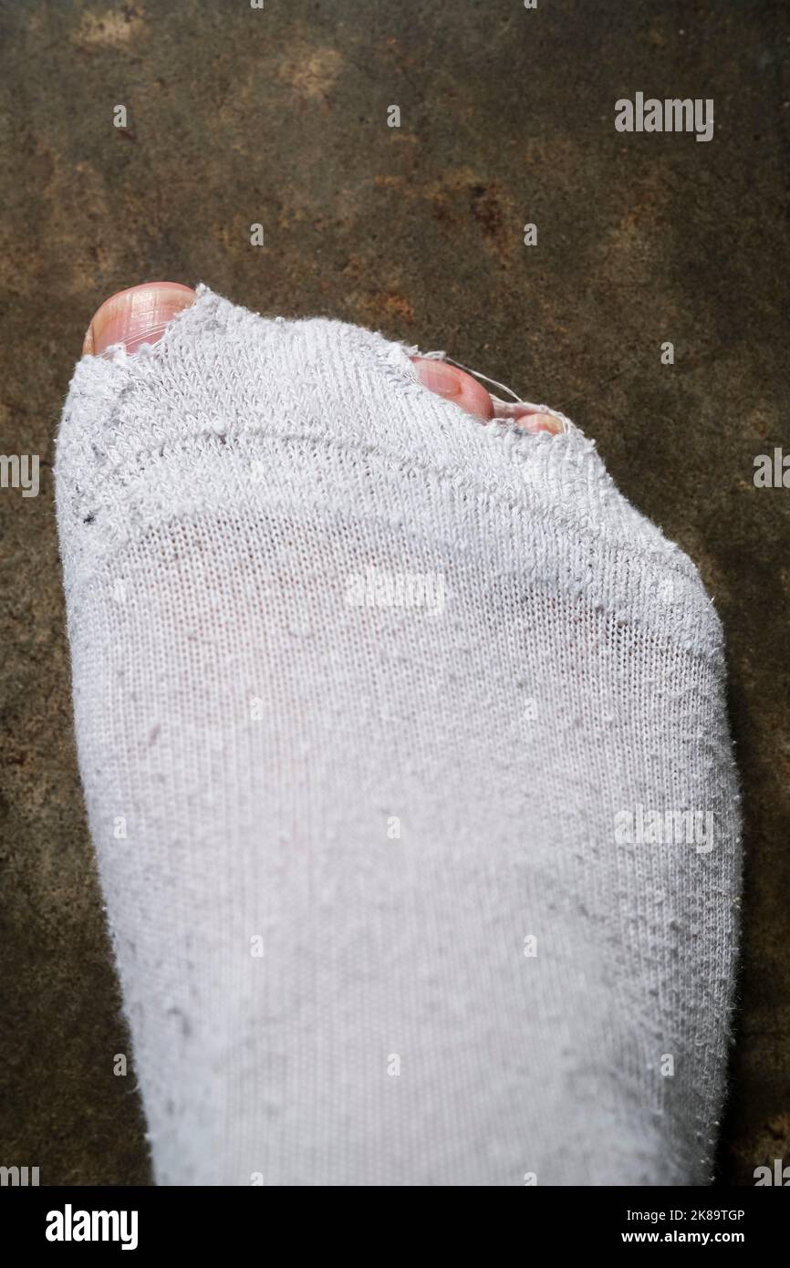 Man toes poking through holes in white socks, hardship concept Stock Photo
