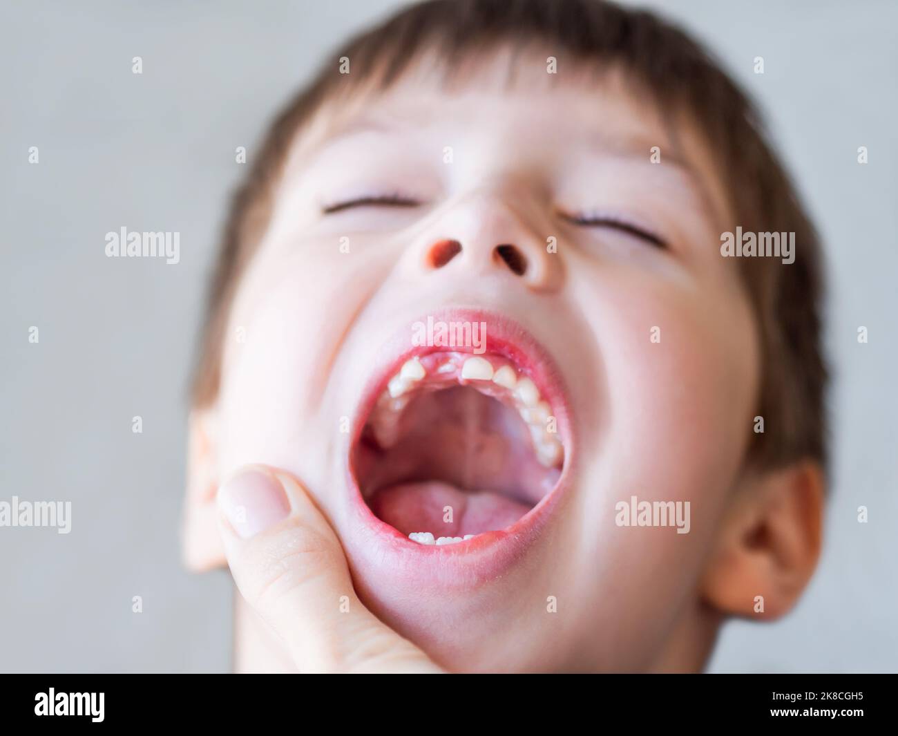 Kid shows hole in row of teeth in his mouth. One incisor fell out just