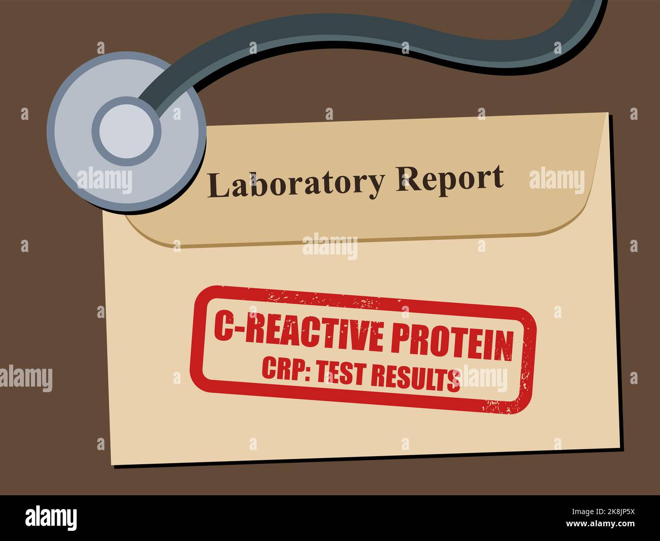 CReactive Protein (CRP) bloodwork laboratory test results. Health