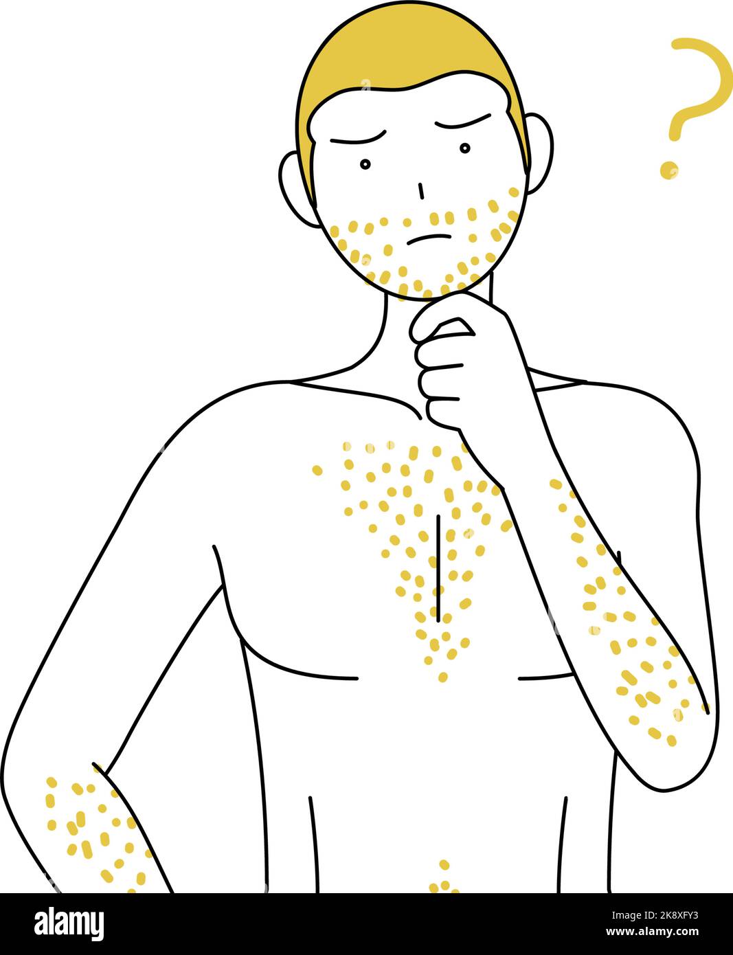 Line drawings of men suffering from thick body hair, tilting his head