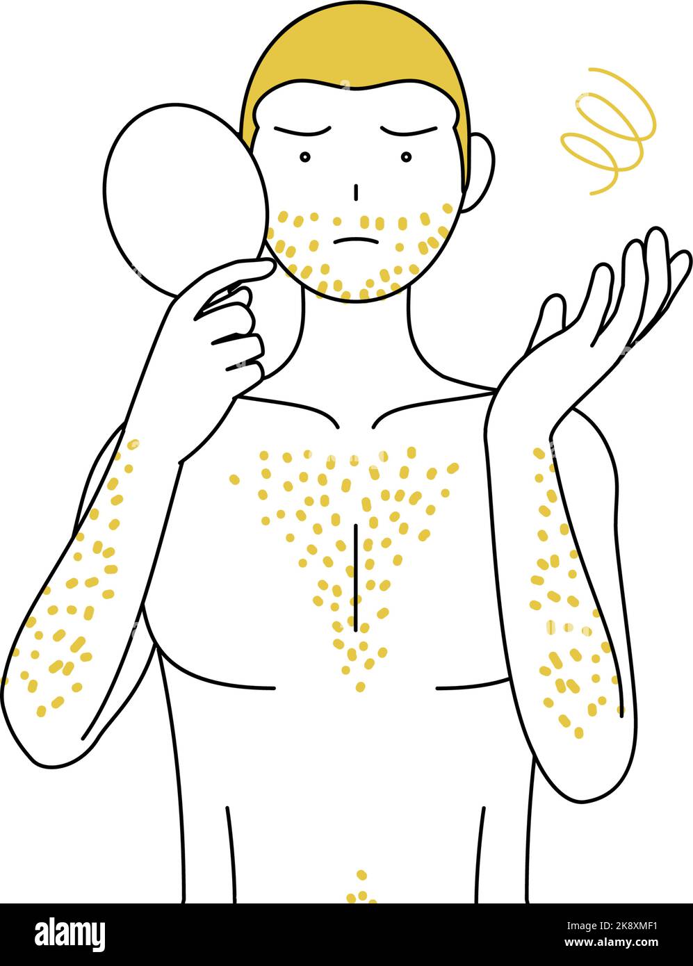 Line drawings of men suffering from thick body hair, pose depressed
