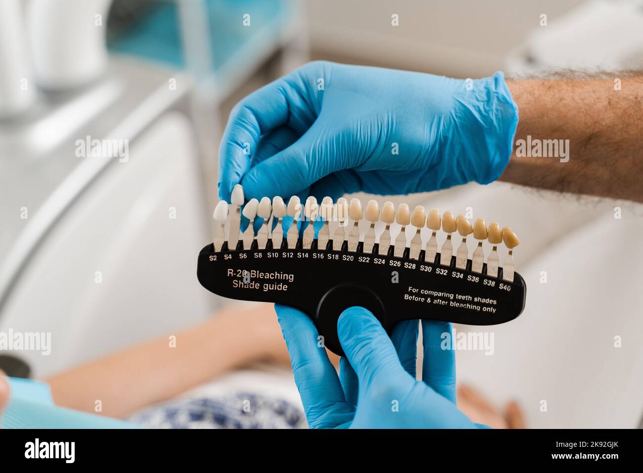 Teeth color shades guide closeup. Dentistry. Veneers or implants teeth