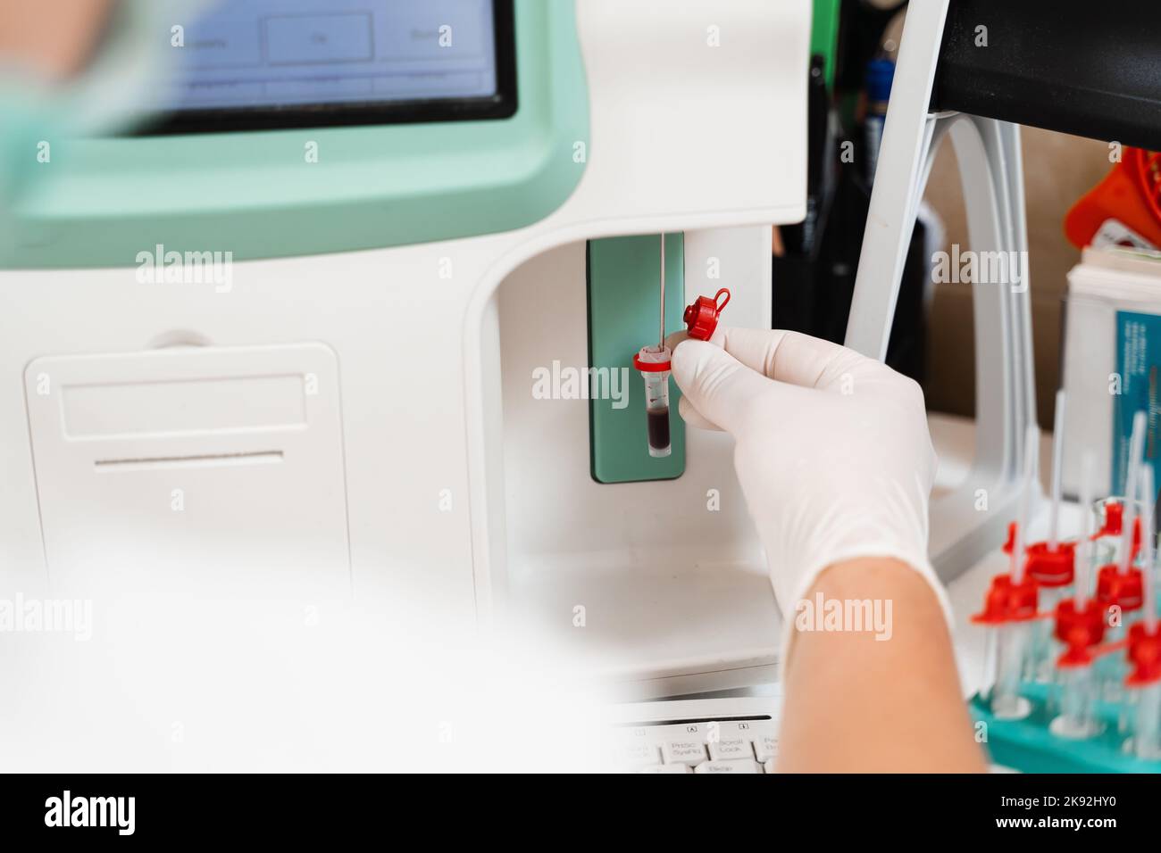 Blood analysis on analyzer in laboratory closeup. Laboratory assistant