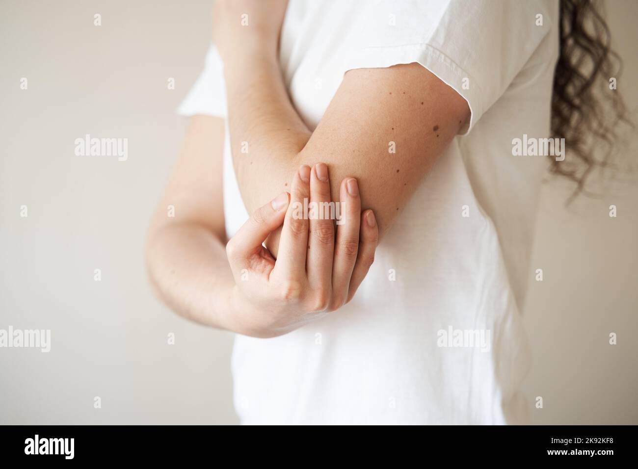 Elbow injury. Beautiful girl with pain and bruise in her arm due to an