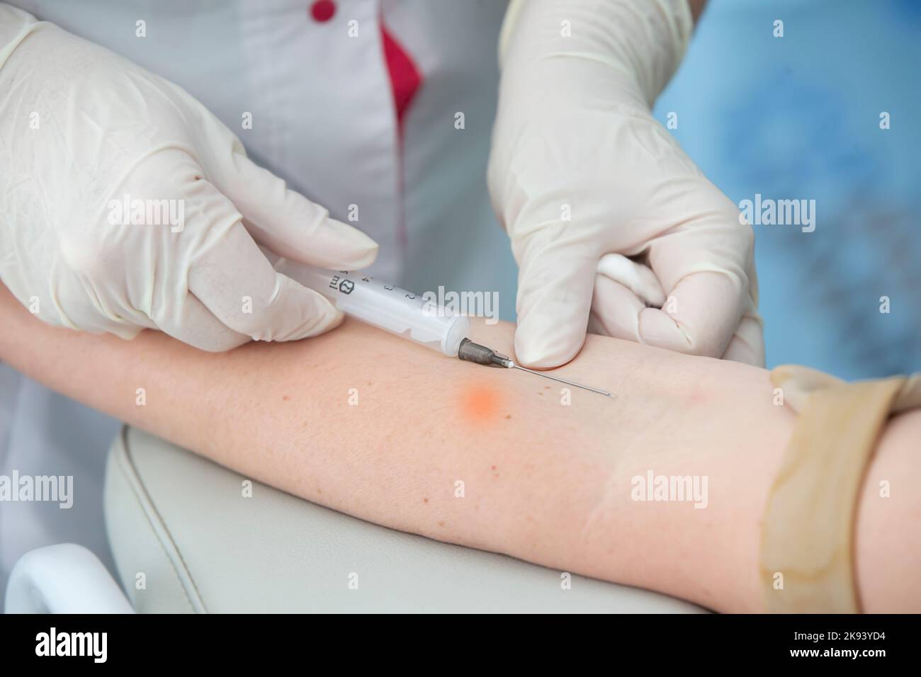 Close-up hand of a nurse, doctor or medical technologist in medical gloves takes a blood sample from a patient in a hospital. Stock Photo