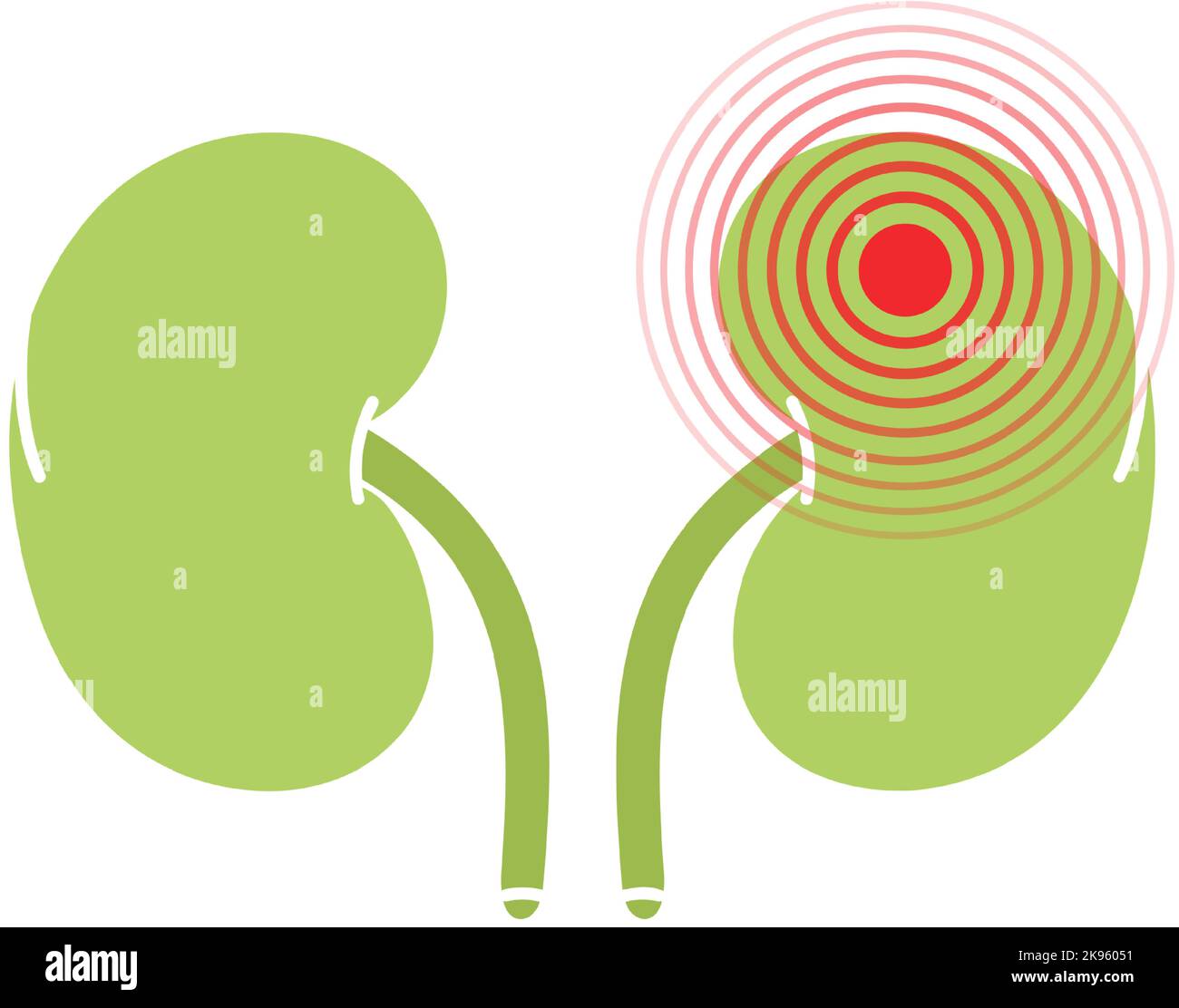 Human kidneys pain symbol. Kidneys ache icon. Vector illustration