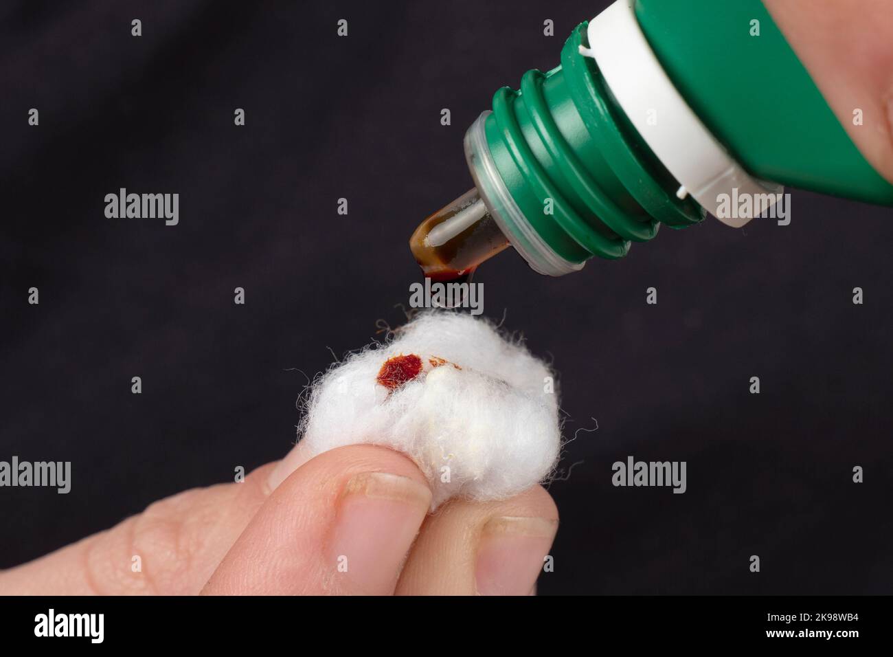 cotton wool and iodine, treatment of radioactive exposure with iodine