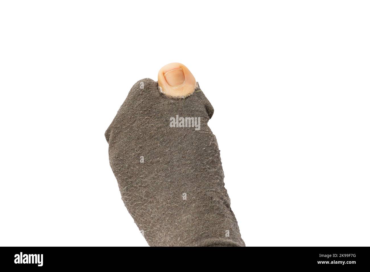 Female legs torn tights from which thumb left on a white background close-up, hole in socks Stock Photo