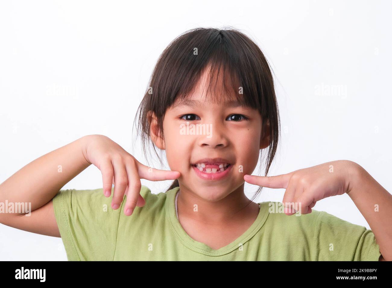 Portrait of an Asian girl with broken upper baby teeth and first