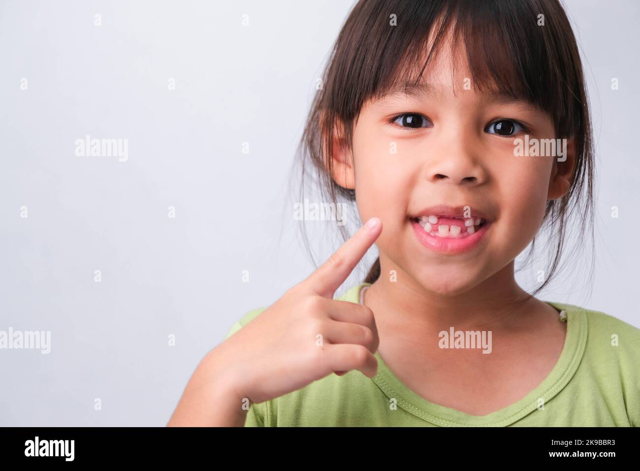Portrait of an Asian girl with broken upper baby teeth and first