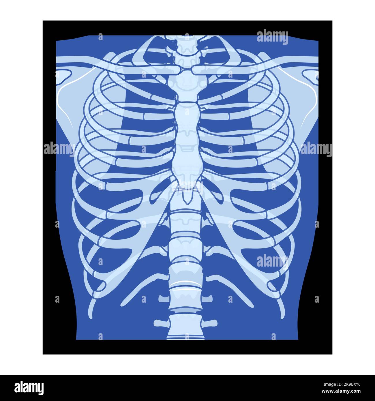 X-Ray Rib cage Skeleton Human body - chest, vertebra, Bones adult people roentgen front view. 3D realistic flat blue color concept Vector illustration of medical anatomy isolated on black background Stock Vector