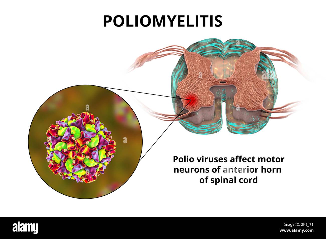 Anterior horn hires stock photography and images Alamy