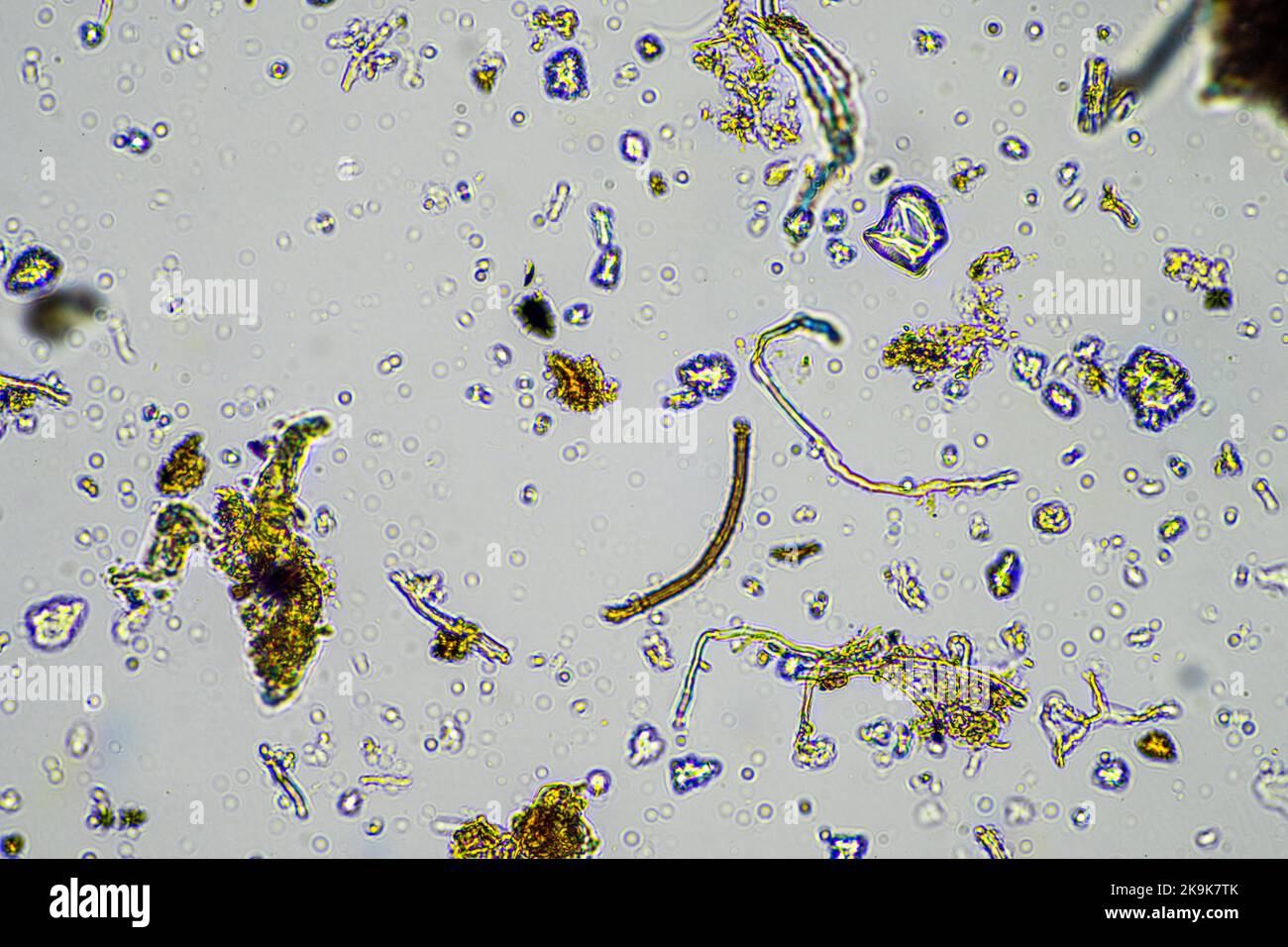 Fungal and fungi hyphae under the microscope in the soil and compost ...