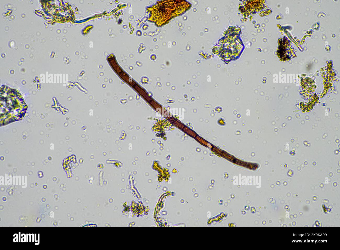 soil sample under the microscope. soil fungi and cycling nutrients in compost in